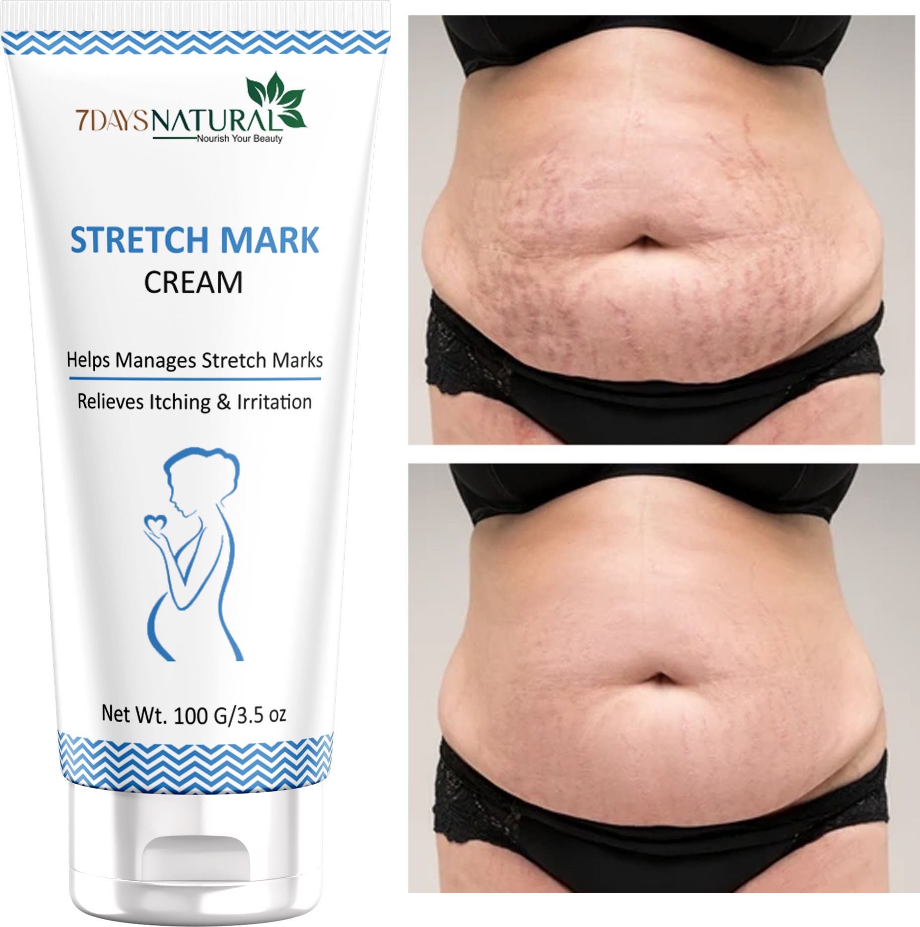 Stretch Marks Removal Cream for Women Men 100% Natural Ayurvedic Cream Intimate Cream-image-30