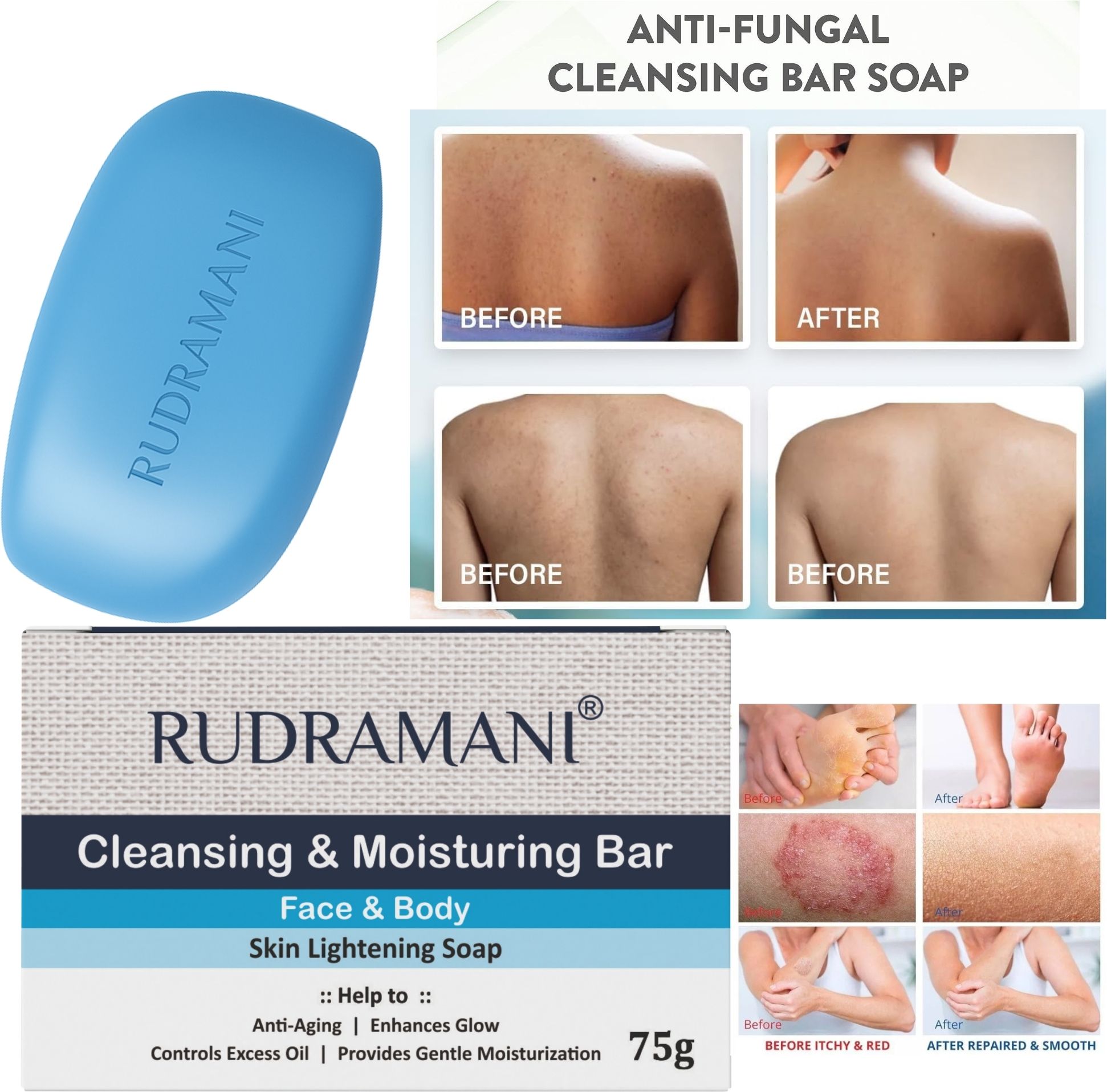 Anti Fungal & Anti Bacterial Soap For Intensive Fungal Infections With Vitamin E-image-20