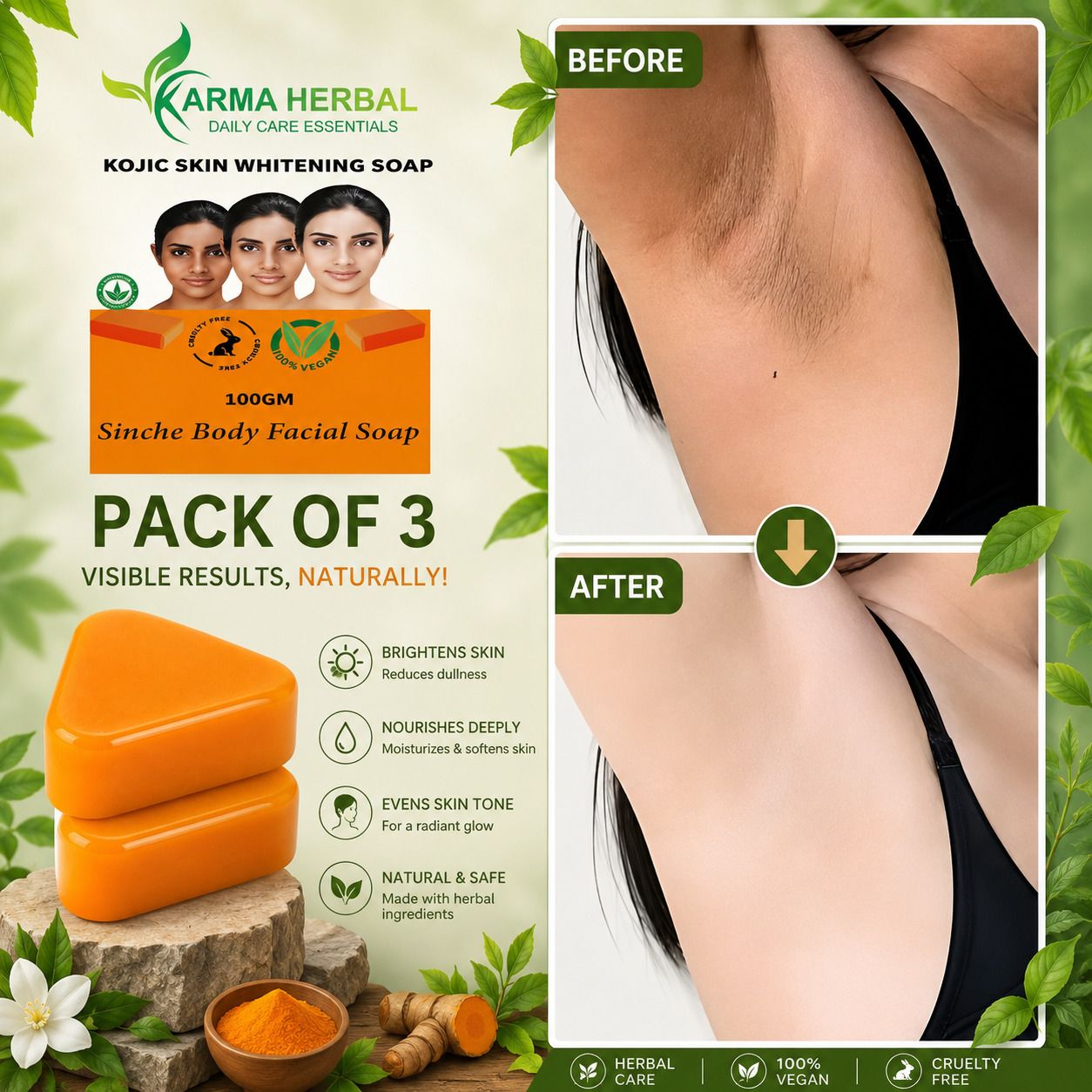Kojic Skin Whitening Soap for Body & Face | Tan Removal & Dark Spot Care |-image-27