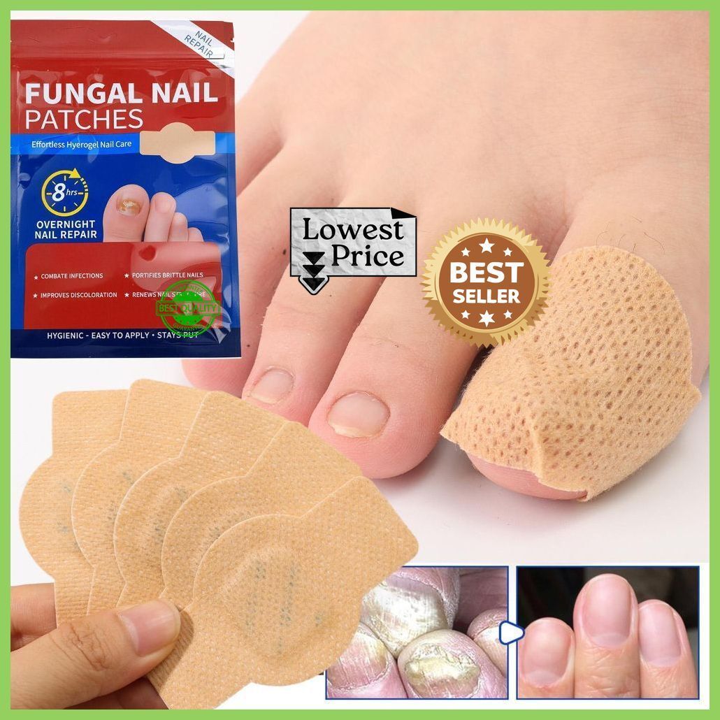 kids craft Advanced Fungal Nail Patch 21P Foot Support-picture-28