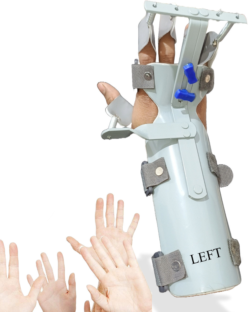 wmio Left Hand Dynamic Cock-up Splint for Wrist Support Pain Relief & Stabilization Splints image 1