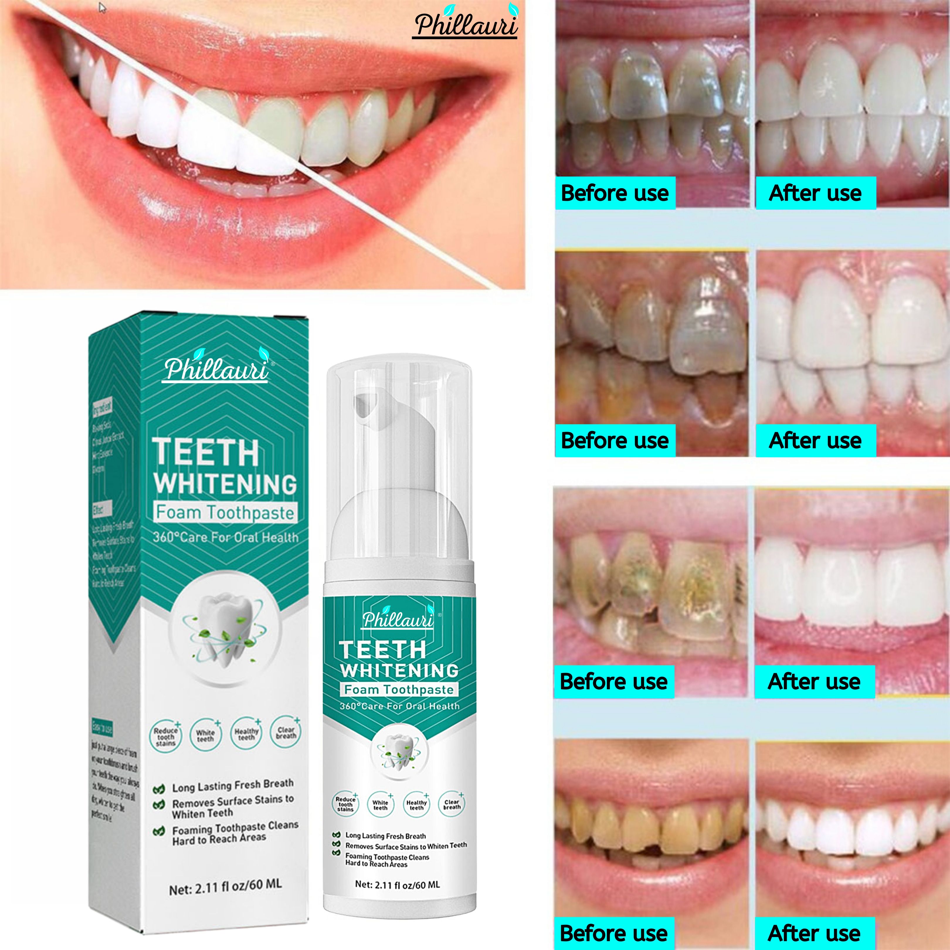 phillauri Teeth Brightens Foam to Fiight Germs Cavity with Mint Extract Teeth Whitening Liquid-picture-28