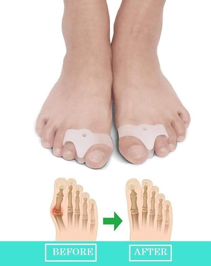 jeerzone toe separator for women men toe straightener for feet big toe protector-picture-15