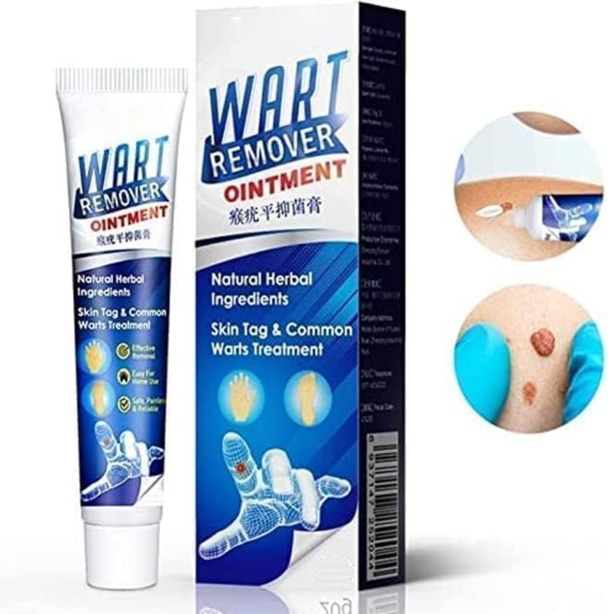 fezora Wart Treatment Unique Cream Warts Remover Ointment Skin Tag Removal & New Skin-picture-27