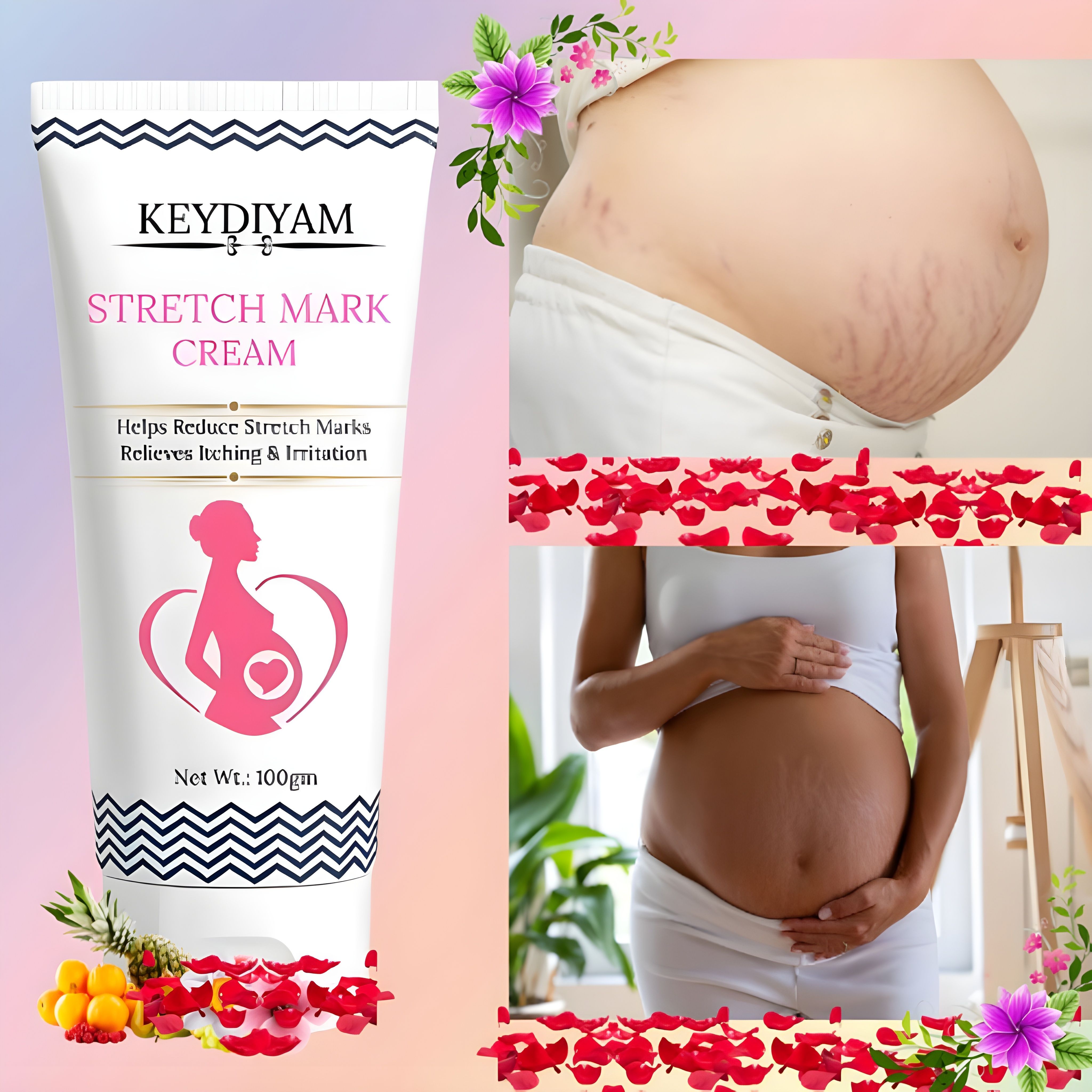 keydiyam Stretch Mark Removal Cream Intimate Cream-picture-35